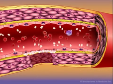 Plaquettes-adhesion-agregation.mp4